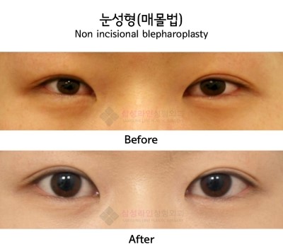 https://inlasik.co.kr/main/data/file/review/20110910140952720.JPG